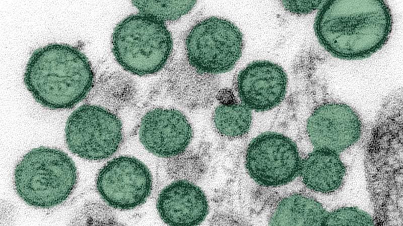 Hantavirus, gli esperti: “Trasmesso dai topi, difficile il contagio tra persone. Ma non c’è cura” 